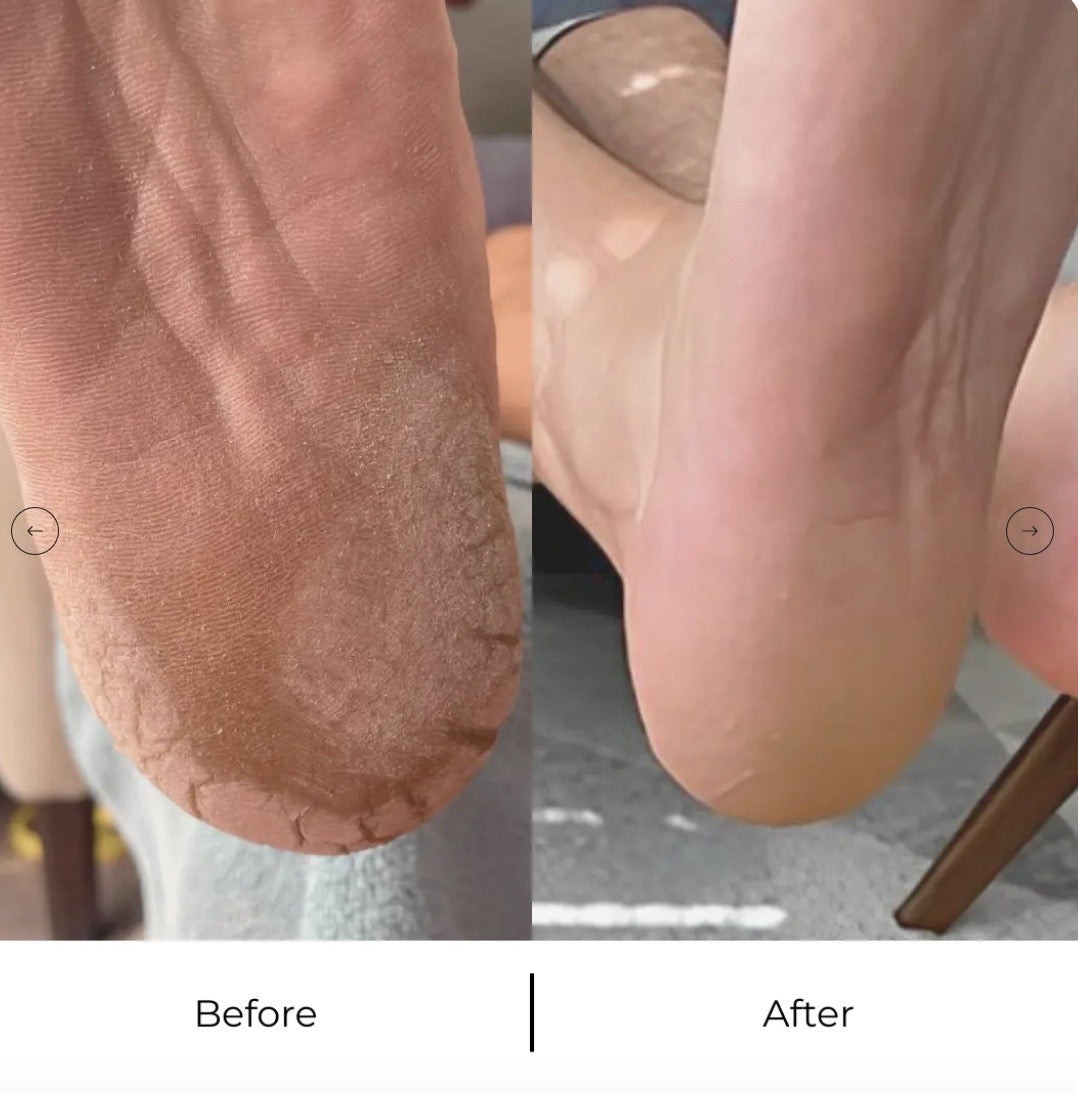 DermaVoet Eeltwisser Pro