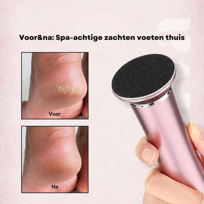 DermaVoet Eeltwisser Pro